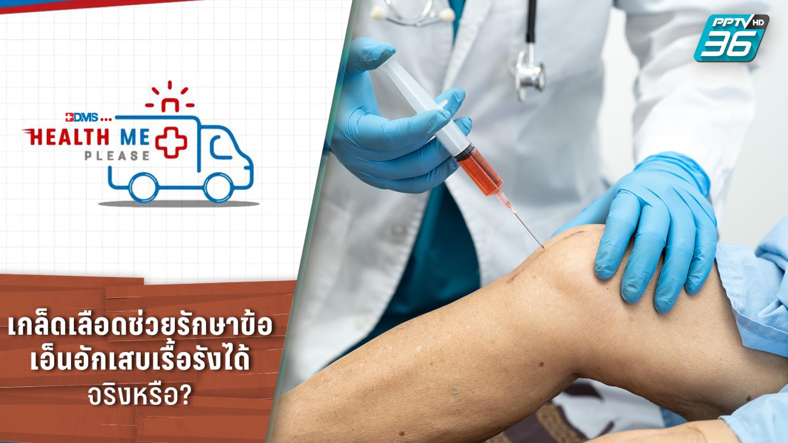 Platelet Therapy for Chronic Tendonitis A Comprehensive Guide on