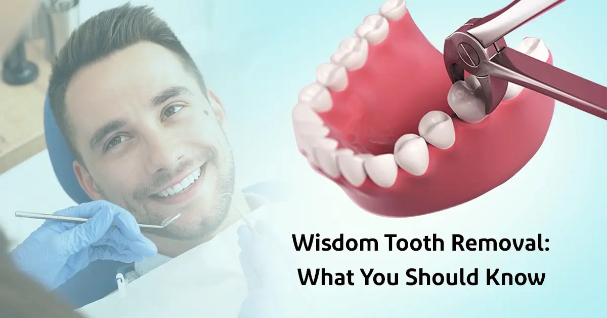 Wisdom Tooth Removal Essential Insights & Information