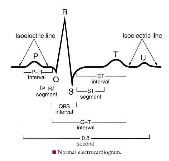 Full Size Picture electrocardiogram.jpg
