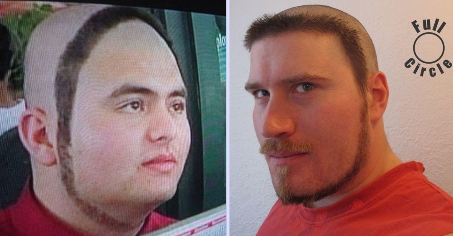 'Circle beard' Is The Latest MustHave Trend For People With Facial