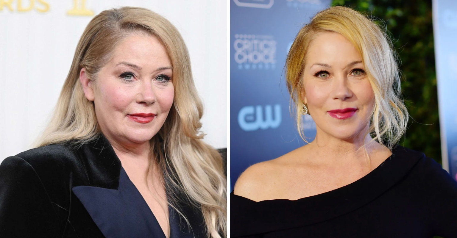 Christina Applegate Says She's 'Probably Not Going To Work On Camera Again'
