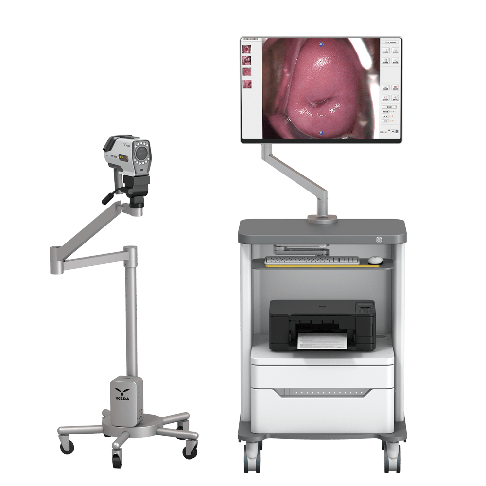 YKD3001 Digital Video Colposcope