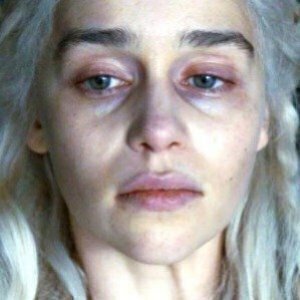 Here's Why Emilia Clarke Never Really Recovered From GOT - ZergNet