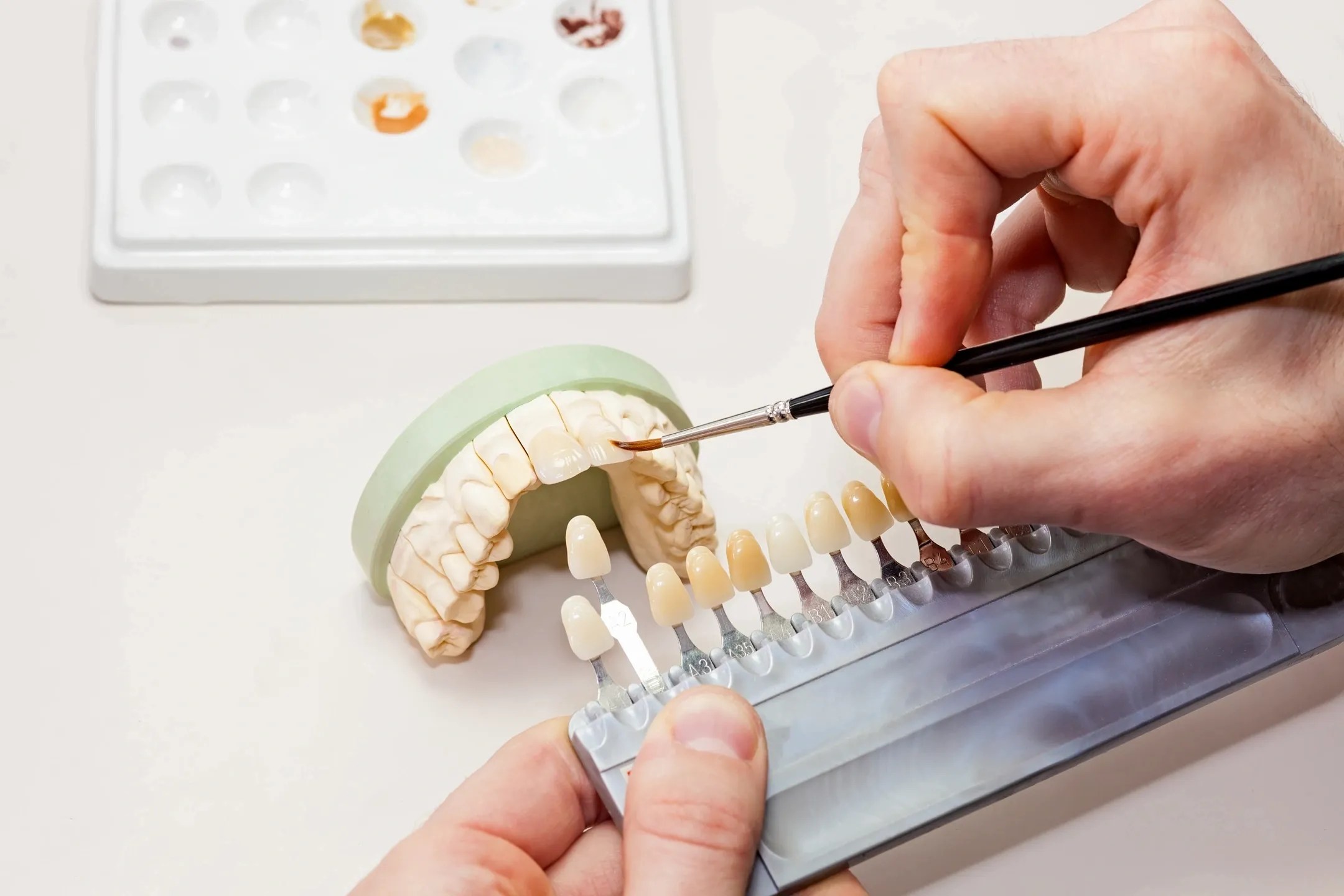 Fine Dental Ceramics