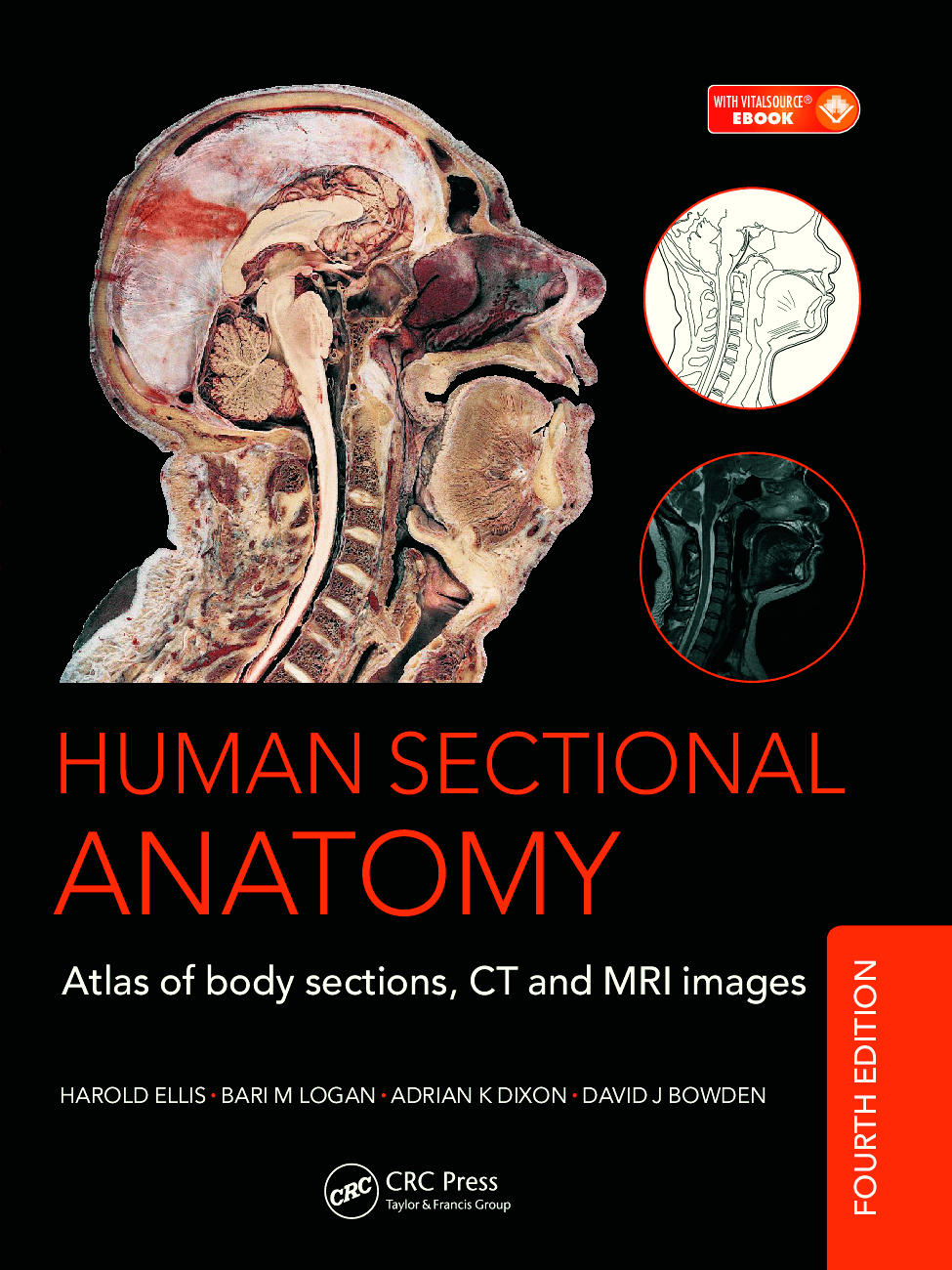Human sectional anatomy atlas of body sections, CT and