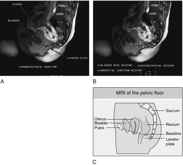 Renal pelvis definition of renal pelvis by Medical dictionary