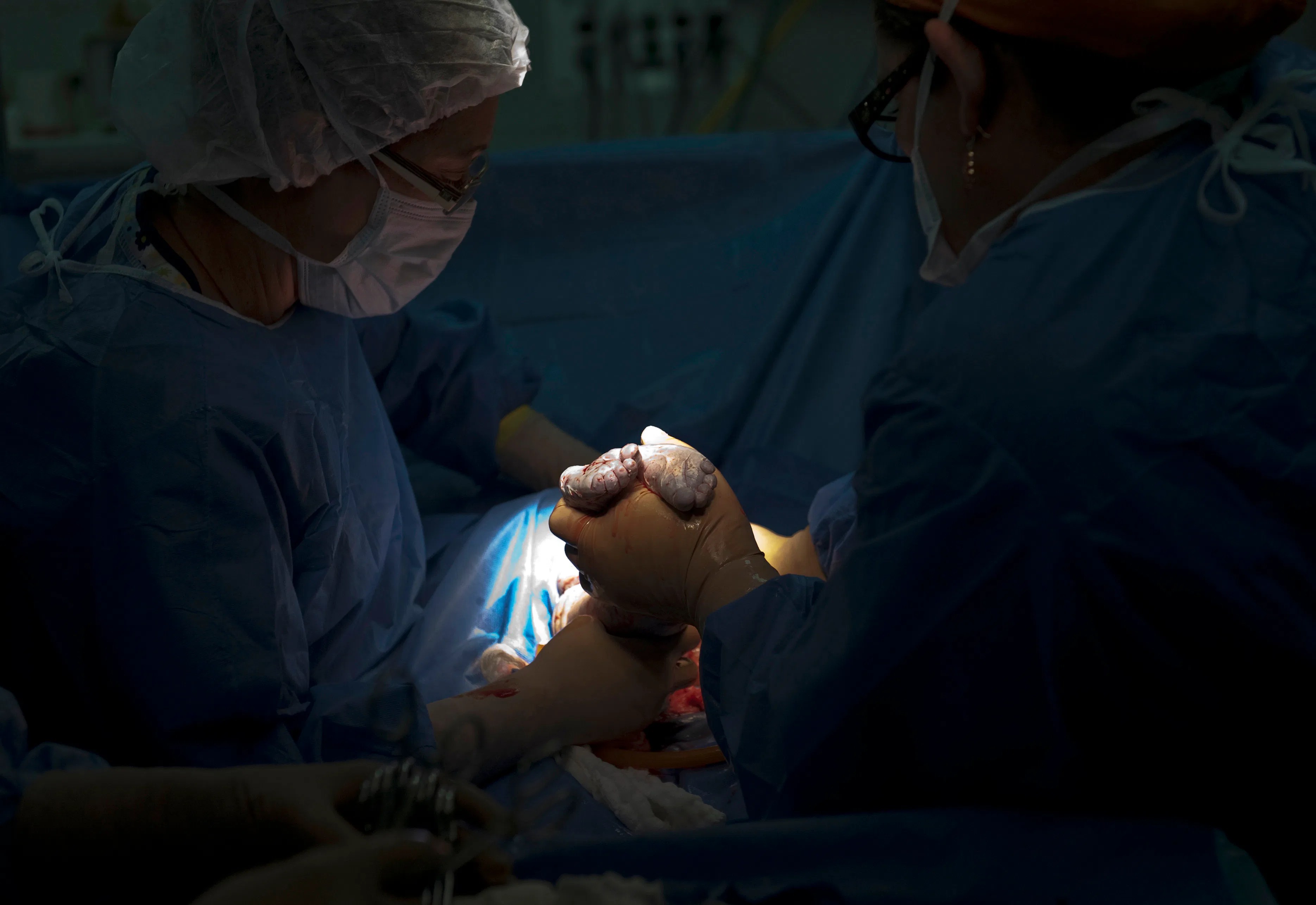 Why Is The US So Addicted To CSections? Rates For The Procedure Keep