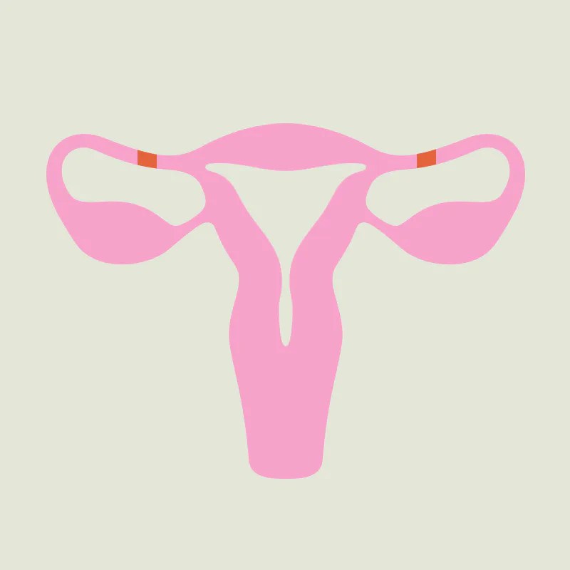 A Guide To Finding The Best Birth Control