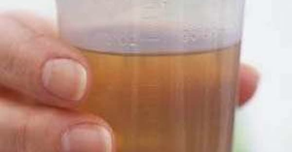 Urinary System Diseases List of Urinary Disorders