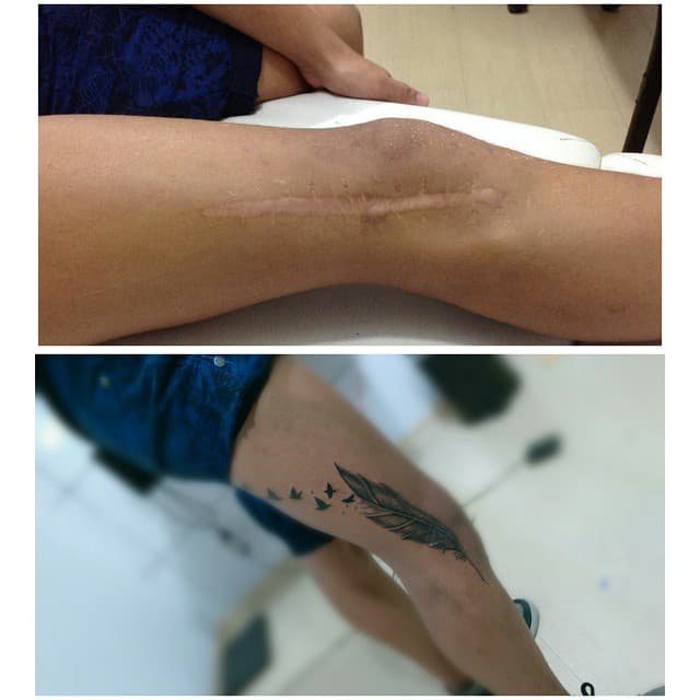 23 Amazing Scar Cover Up Tattoos That Will Blow You Away 750_x_750_jpg