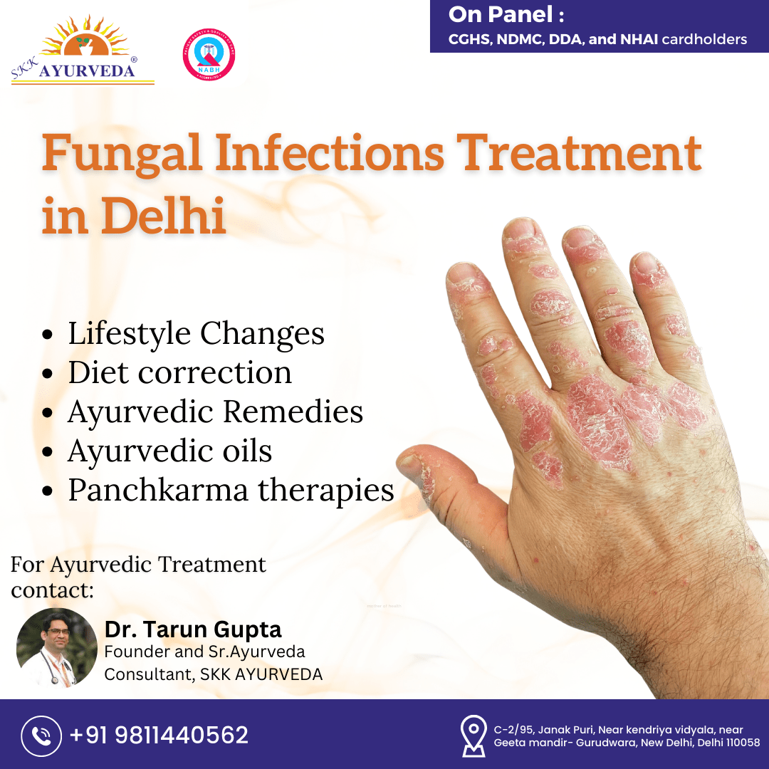Fungal Infections Treatment in Delhi ImgPile