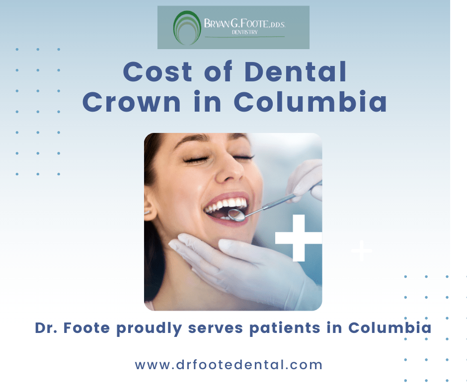 Cost of Dental Crown in Columbia ImgPile