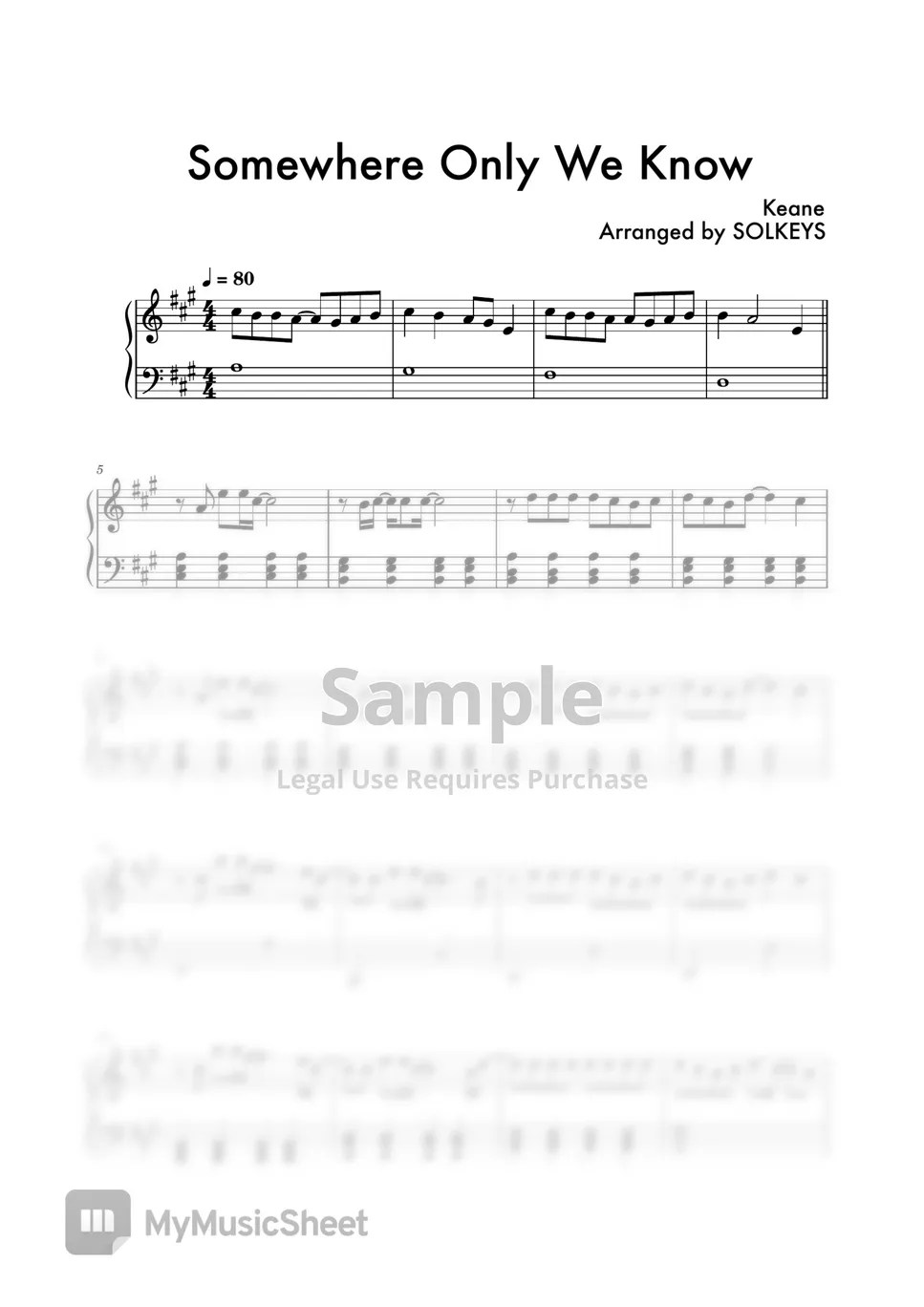 Keane Somewhere Only We Know Sheets by SolKeys