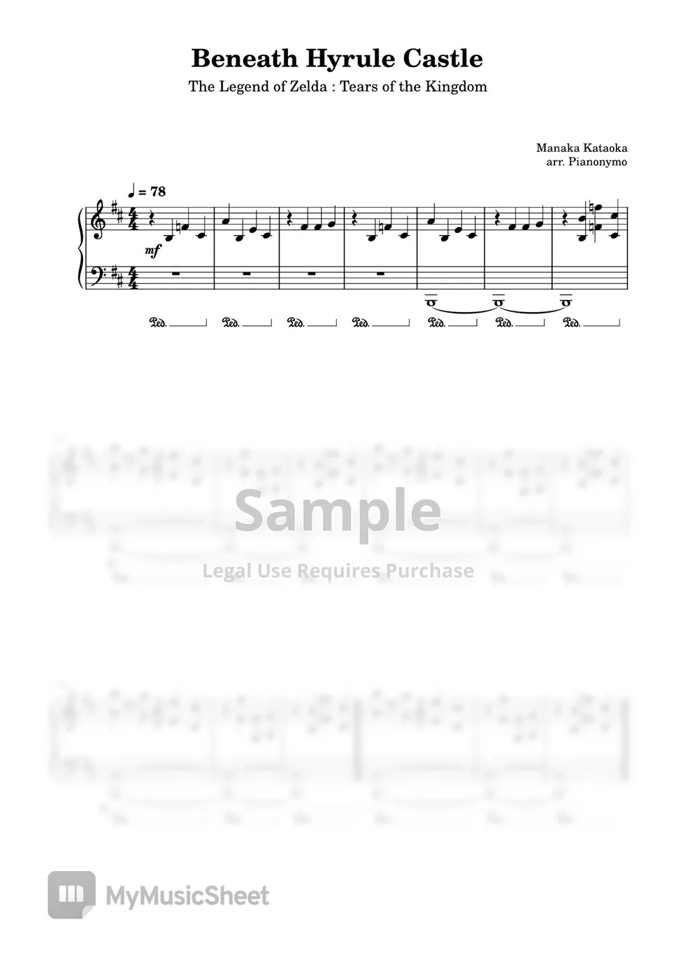 Zelda Tears of the Kingdom BENEATH HYRULE CASTLE (Prologue) Hoja by