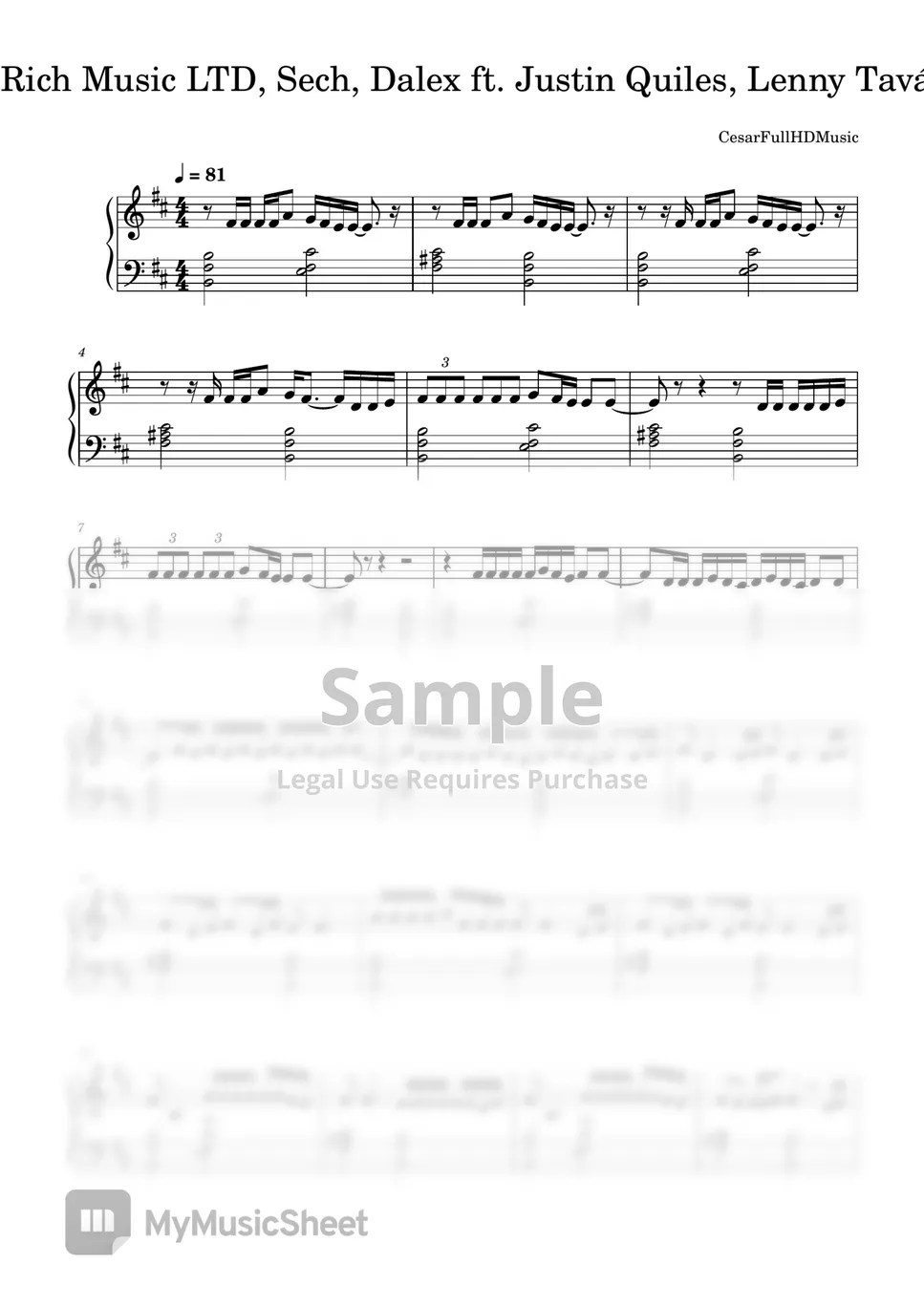 Rich Music LTD, Sech, Dalex ft. Justin Quiles, Lenny Tavárez, Feid