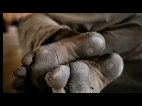 ወዳጄ ከሰላሳ አመትህ በፊት የሠራኸው ስህተት ዋጋ ያስከፍልሀል My Friend The Mistake You Made Thirty Years Ago Will Coast