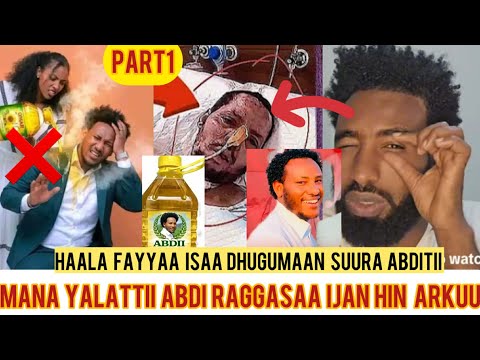 Ija Mirgatiin Xiqqo Arkaa Halaa Ammaa Abdi Raggasaa Mana Hakimatti Ittii Jiraan