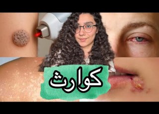 Skin Diseases You Might Get Are Caused By Things You Underestimate