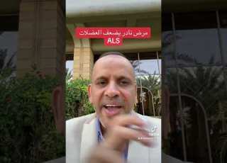  ضمور العضلات الجانبي ALS