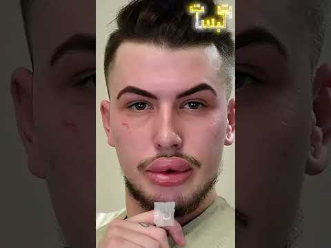 أسوء 3 عمليات تجميل في العالم