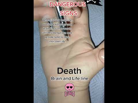 Dangerous Signs On Hand Palmist Palmistry Palmistry001 Dangerous Signs On Hand Palmist Palmistry Palmistry001