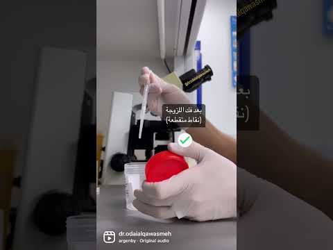 لزوجة السائل المنوي