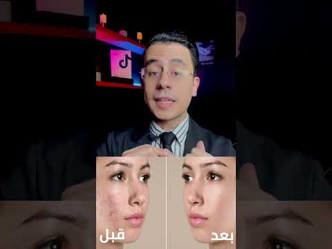 كريم السحر اللي هايغير بشرتك