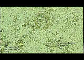 Hymenolepis Nana Egg