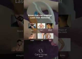  Why Should Men Get Laser Beard Hair Removal