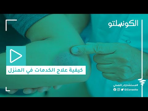 كيفية علاج الكدمات في المنزل