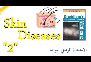 الأمراض الجلدية 2 الحزاز المسطح دافيدسون بالعربي Lichen Planus