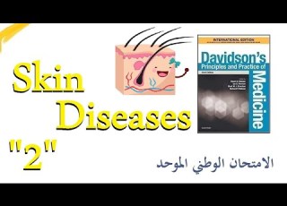 الأمراض الجلدية 2 الحزاز المسطح دافيدسون بالعربي Lichen Planus