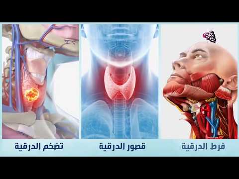 ما هي أعراض خلل الغدة الدرقية