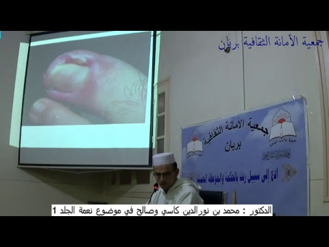 الدكتور محمد بن نورالدين كاسي وصالح في موضوع نعمة الجلد 1