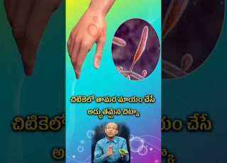  త మర మ య చ స అద భ తమ న చ ట క Shorts Viral Trending Itching Ringworm Natural Homeremedies