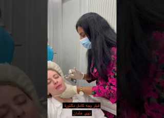 فيلر وجه كامل ابلور تجميل Explore فيلر اليوم الوطني جدة ليزر Beauty اليوم جمال عناية