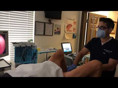 إجراء ريزوم الثوري الذي تم إجراؤه في مركز زد لطب المسالك البولية في جنوب فلوريدا