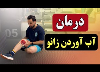  درمان آب آوردن زانو