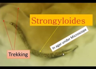  Strongyloidiasis Cause And Its Pathogenesis Strongyloides Under Microscope