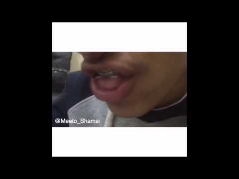 ميتو جميع مقاطع ميتو