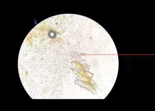 Hymenolepis Nana The Dwarf Tapeworm