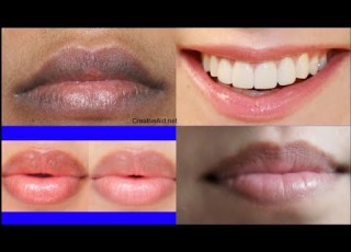 علاج قوي وطبيعي للتخلص من اللون الداكن على الشفاه وحول الشفاه