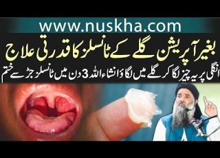 بغیر آپریشن گلے کے ٹانسلز کا قدرتی علاج انگلی پر یہ چیز لگا کر گلے میں لگاو Dr Sharafat Ali New