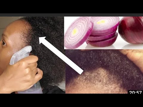 Rifeensa Keenya Fulduran Nuura Dhume Ykn Haaphaate Akkaamiti Deebisne Magarfachu Dandeenya