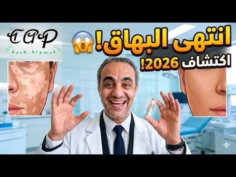 وداعا للبهاق للأبد اكتشاف 2026 الذي سيغير حياتك رسميا بهاق علاج البهاق كبسولة طبية Viral