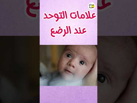 علامات التوحد عند الرضع