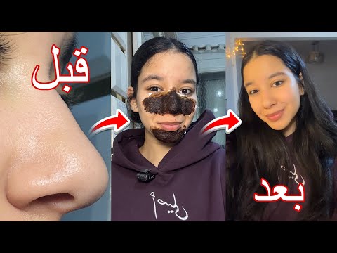 التخلص من الرؤوس السوداء بمكونين فقط في كل بيت من اول مره هتتخلصي من كل الرؤوس تجهيزات العيد