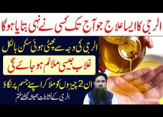 Skin Ki Kharish Ka Skin Allergy Ka Ilaj Skin Ki Bimari Skin Ki Redness Ka Ilaj Dr Sharafat Ali