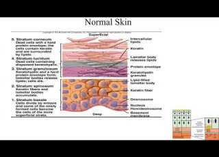 Pathology Made Easy Systemic Pathology 14 Skin Diseases 1 Introduction