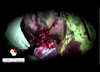 يا دم الشهداء لن تضيع هباء أحرار للتغيير
